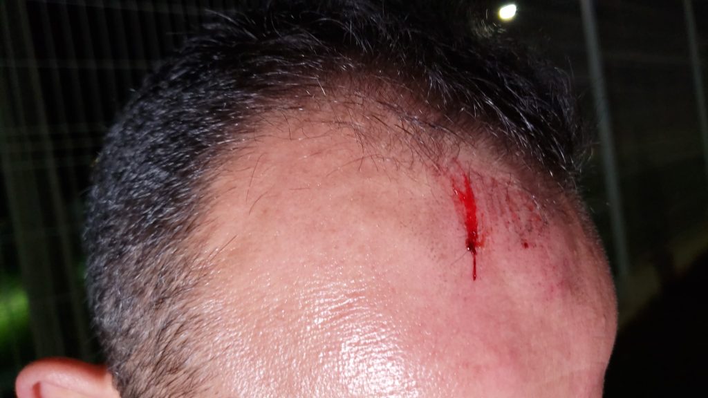 Condutor é agredido por assaltantes no Centro de Cascavel Condutor é agredido por assaltantes no Centro de Cascavel