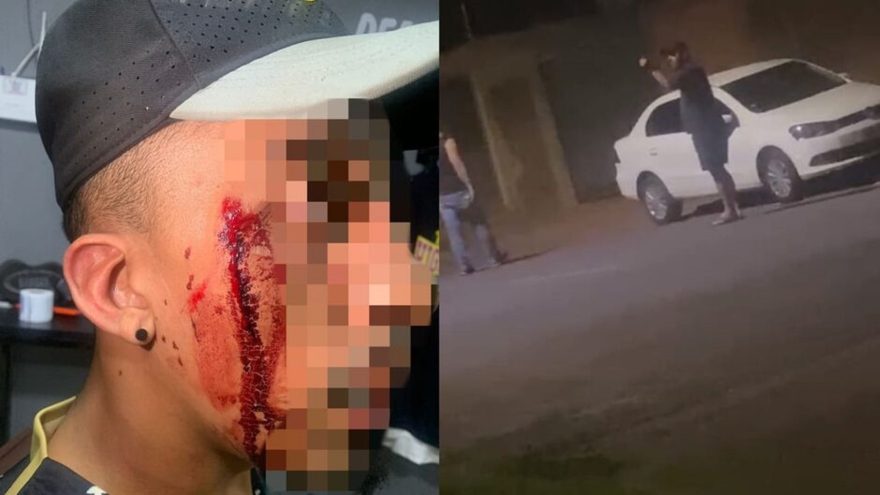 Barbeiro acusa policial de coronhadas e racismo: caso sob investigação