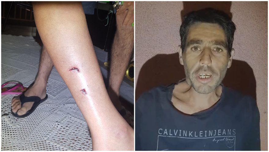 Internauta é atacada por cachorros de rua no Alto Alegre