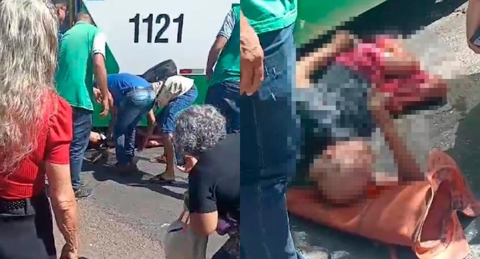 Idoso tem a pele arrancada após ser atropelado por ônibus dentro de terminal Idoso tem a pele arrancada após ser atropelado por ônibus dentro de terminal