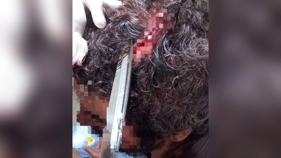 Homem é agredido com martelada e tijolada na cabeça Homem é agredido com martelada e tijolada na cabeça