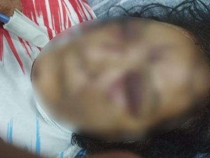 Tentativa de feminicídio em Rio do Salto: primeira audiência do caso ocorre hoje (03)