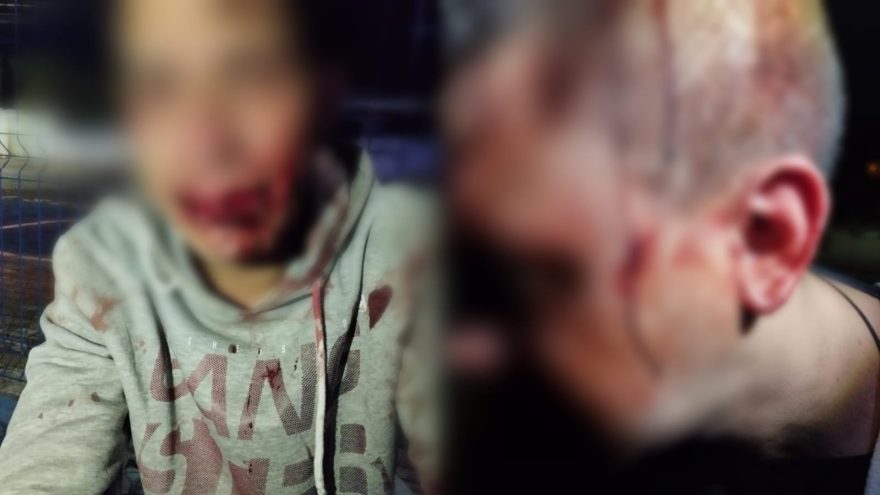 5 minutos sem perder a amizade: jovens saem no soco e pedem socorro na base da GM