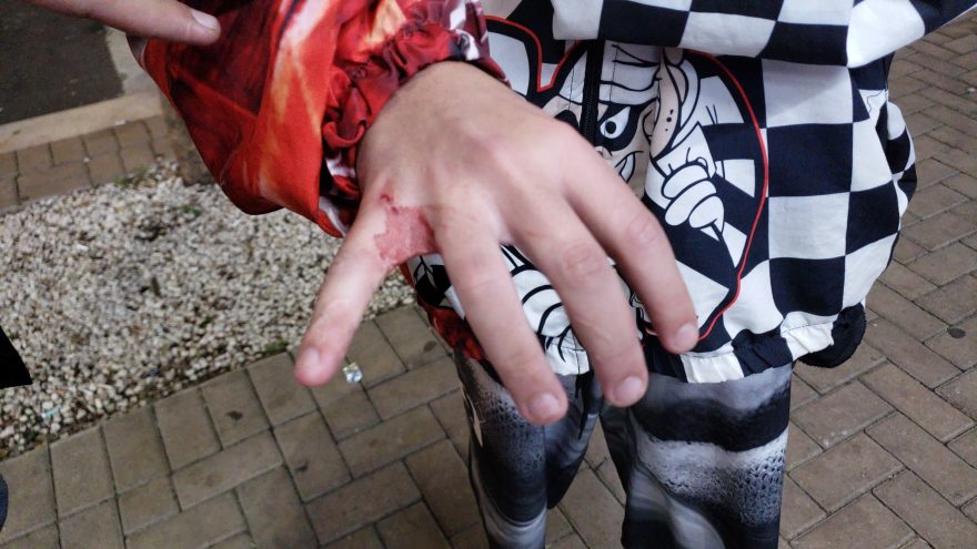Três jovens são socorridos pelo Siate após agressão na Avenida Brasil