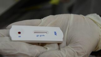 Saúde orienta farmácias sobre testes para HIV, sífilis e hepatites