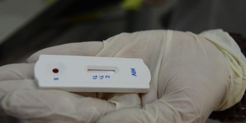 Imagem referente a Saúde orienta farmácias sobre testes para HIV, sífilis e hepatites