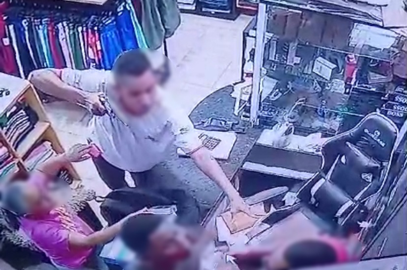 Impressionante: lojista é baleado no rosto durante assalto