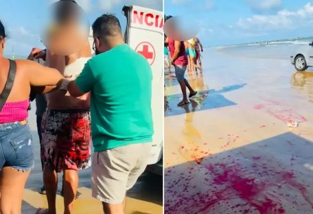 Imagem referente a Homem é esfaqueado na areia da praia, após molhar suspeito quando passava de carro