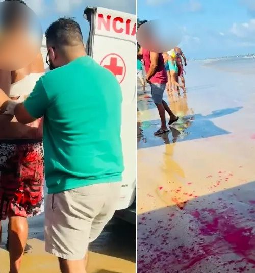 Imagem referente a Homem é esfaqueado na areia da praia, após molhar suspeito quando passava de carro