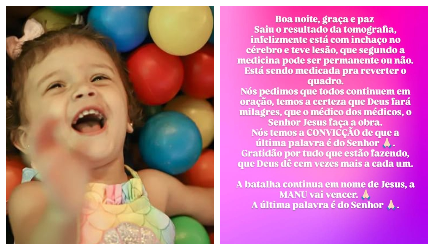 Resultado de tomografia mostra lesão no cérebro de Manu e pai pede orações Resultado de tomografia mostra lesão no cérebro de Manu e pai pede orações