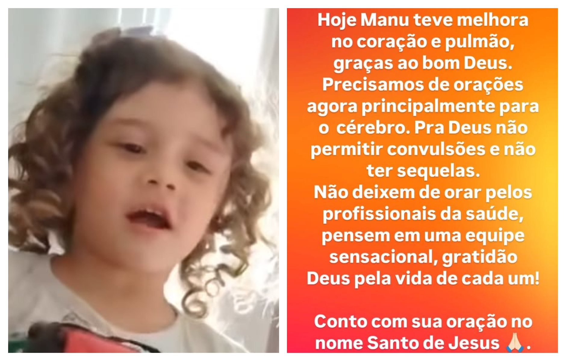 Pequena Manu apresenta progresso após acidente, mas cérebro ainda é motivo de preocupação Pequena Manu apresenta progresso após acidente, mas cérebro ainda é motivo de preocupação
