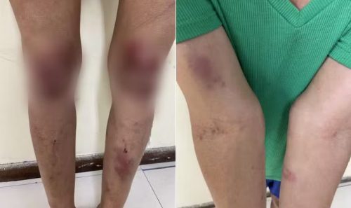 Imagem referente a Mulher é torturada e arrastada de joelhos com coleira de cachorro por traficantes a mando de marido