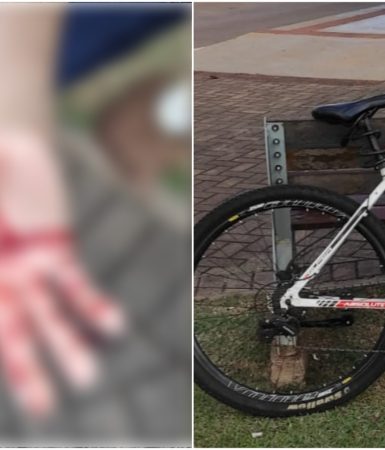 Imagem referente a Idoso fica ferido ao sofrer queda de bicicleta na Avenida Brasil