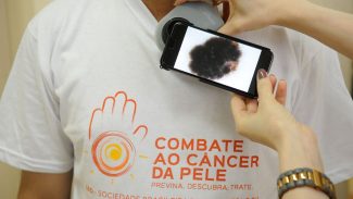 Mutirão atende população hoje, no dia de combate ao câncer de pele