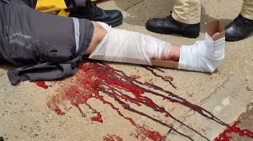 Motociclista quebra a perna ao se envolver em acidente no Angra dos Reis