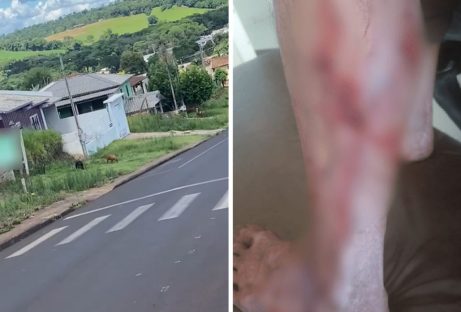 Imagem referente a Pedestre busca refúgio em ambulância após ataque de pitbulls agitados