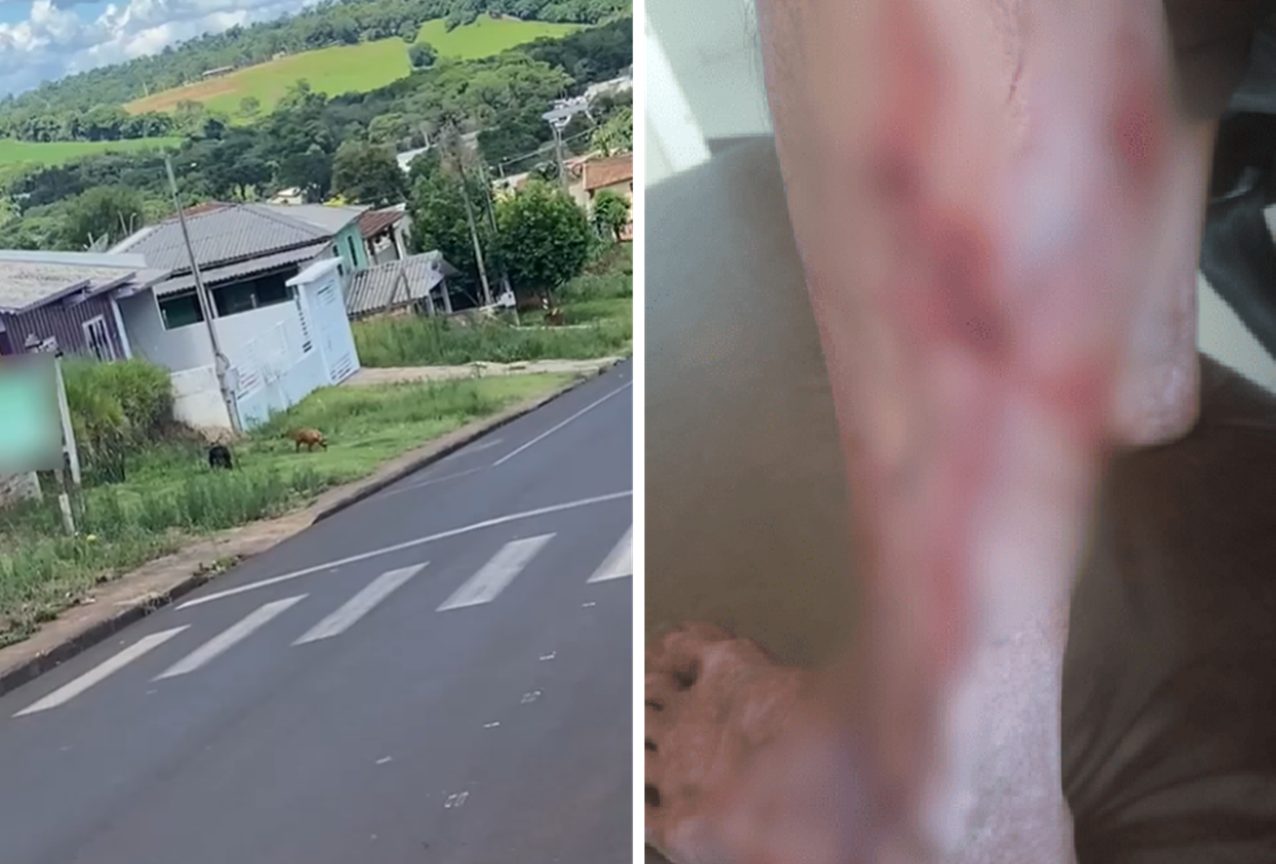 Pedestre busca refúgio em ambulância após ataque de pitbulls agitados