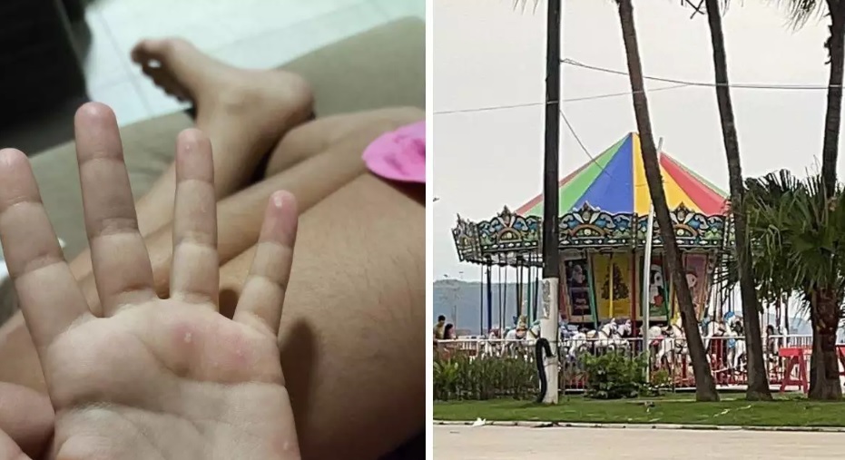 Criança sofre descarga elétrica em brinquedo e queima as mãos