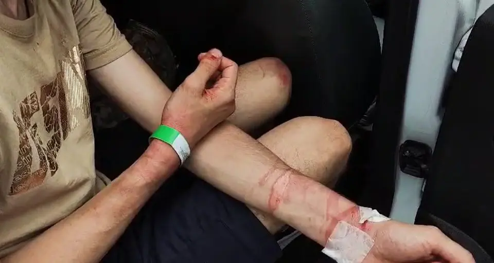 Cabeleireiro é amarrado e torturado após marcar encontro com homem casado