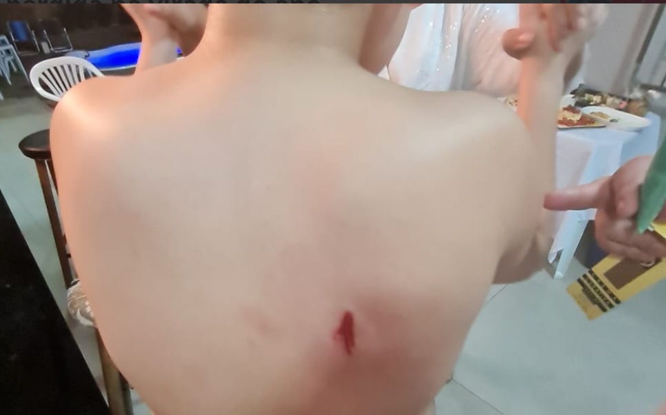 Criança de 11 anos é atingida por “bala perdida” na virada do ano em Foz do Iguaçu