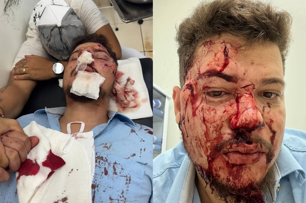 Cantor é agredido com garrafa e fica com rosto desfigurado