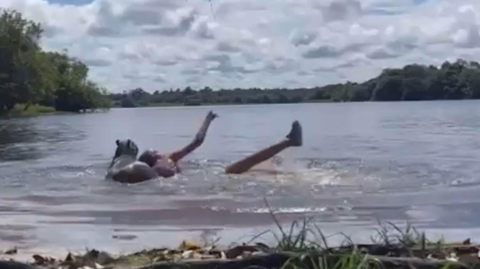 Adolescente é atacada por capivara em lago Adolescente é atacada por capivara em lago