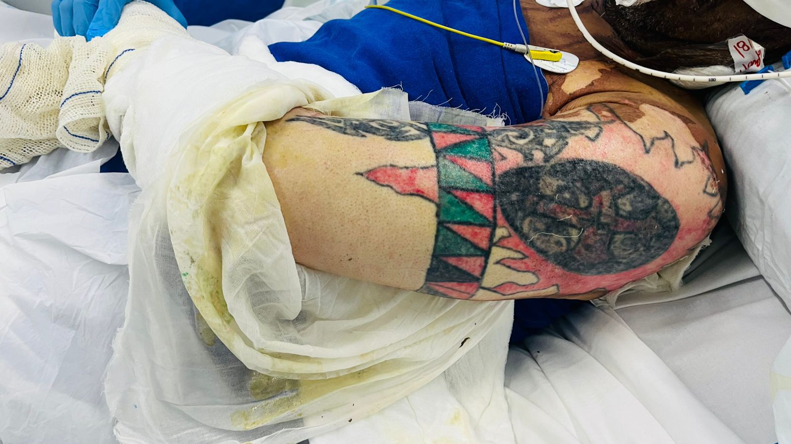Hospital Universitário procura por familiares de paciente internado na UTI