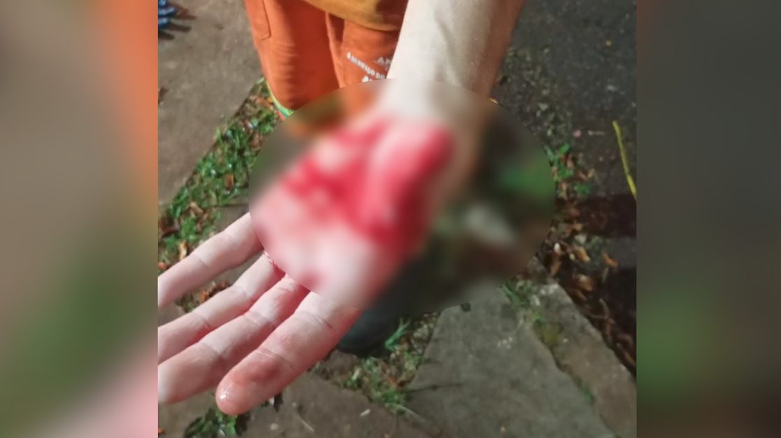 Coletor de lixo corta a mão e faz apelo emocionado por mais cuidado no descarte