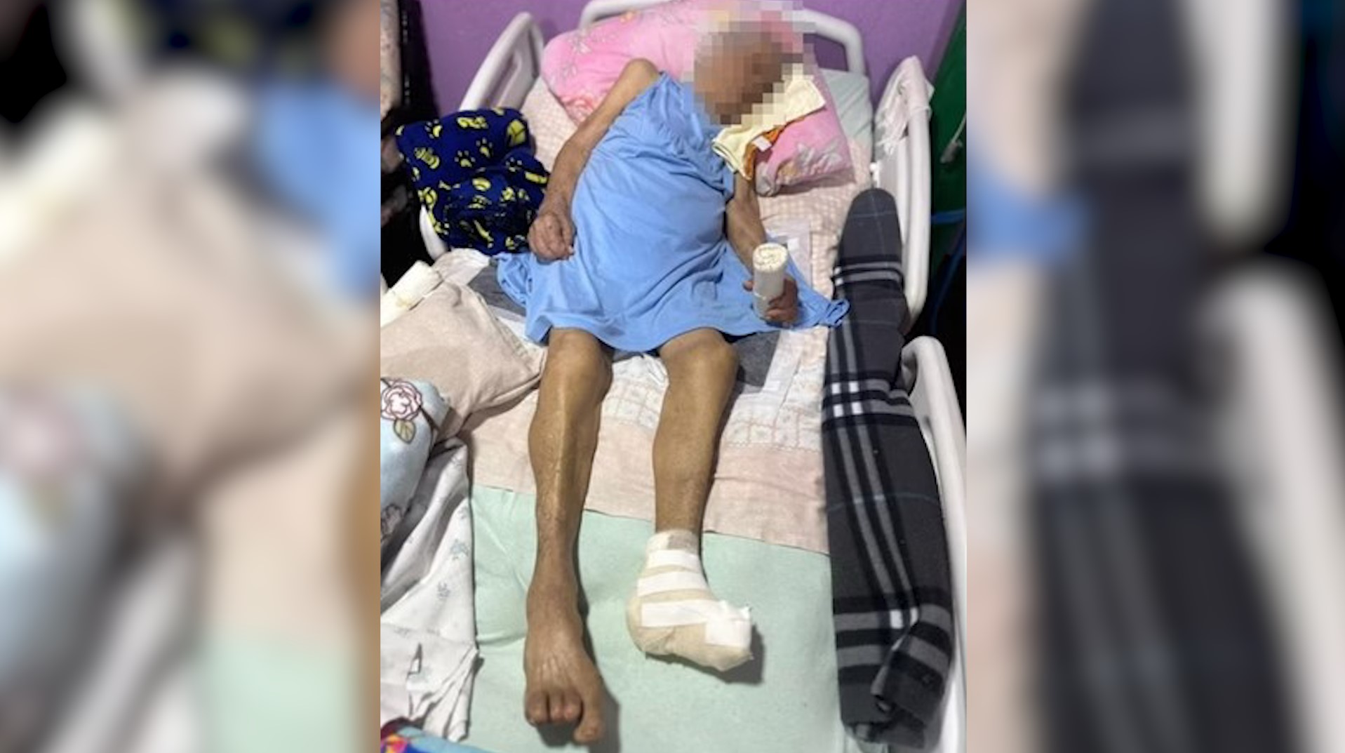 Enfermeira amputa pé de idosa de 103 anos com bisturi cego em cirurgia clandestina Enfermeira amputa pé de idosa de 103 anos com bisturi cego em cirurgia clandestina
