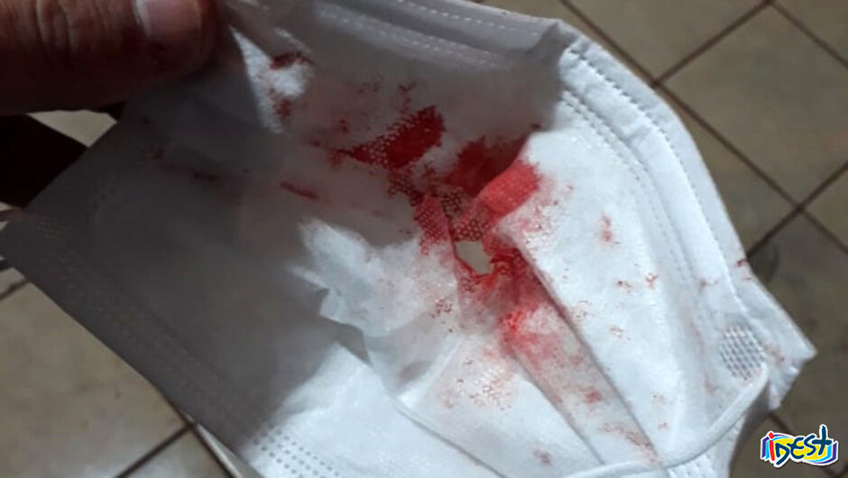 Jovem de 29 anos morre após crise de tosse com sangue Jovem de 29 anos morre após crise de tosse com sangue