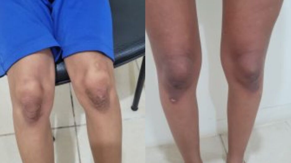 Mãe e madrasta são presas por tortura e violência psicológica contra crianças