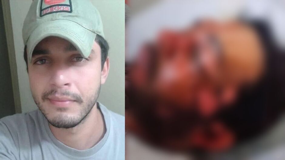 Jovem de 29 anos pode perder o olho após ataque com água fervente