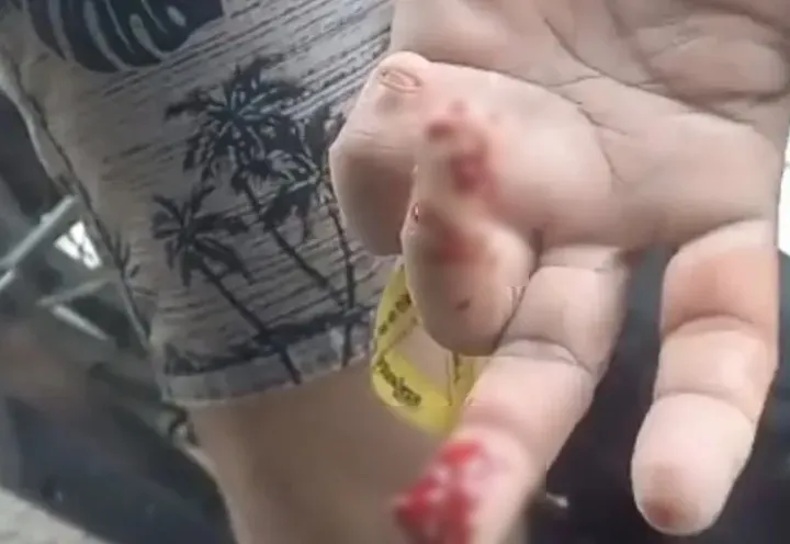 Piranhas atacam banhistas: fenômeno pode ser resultado de enchentes