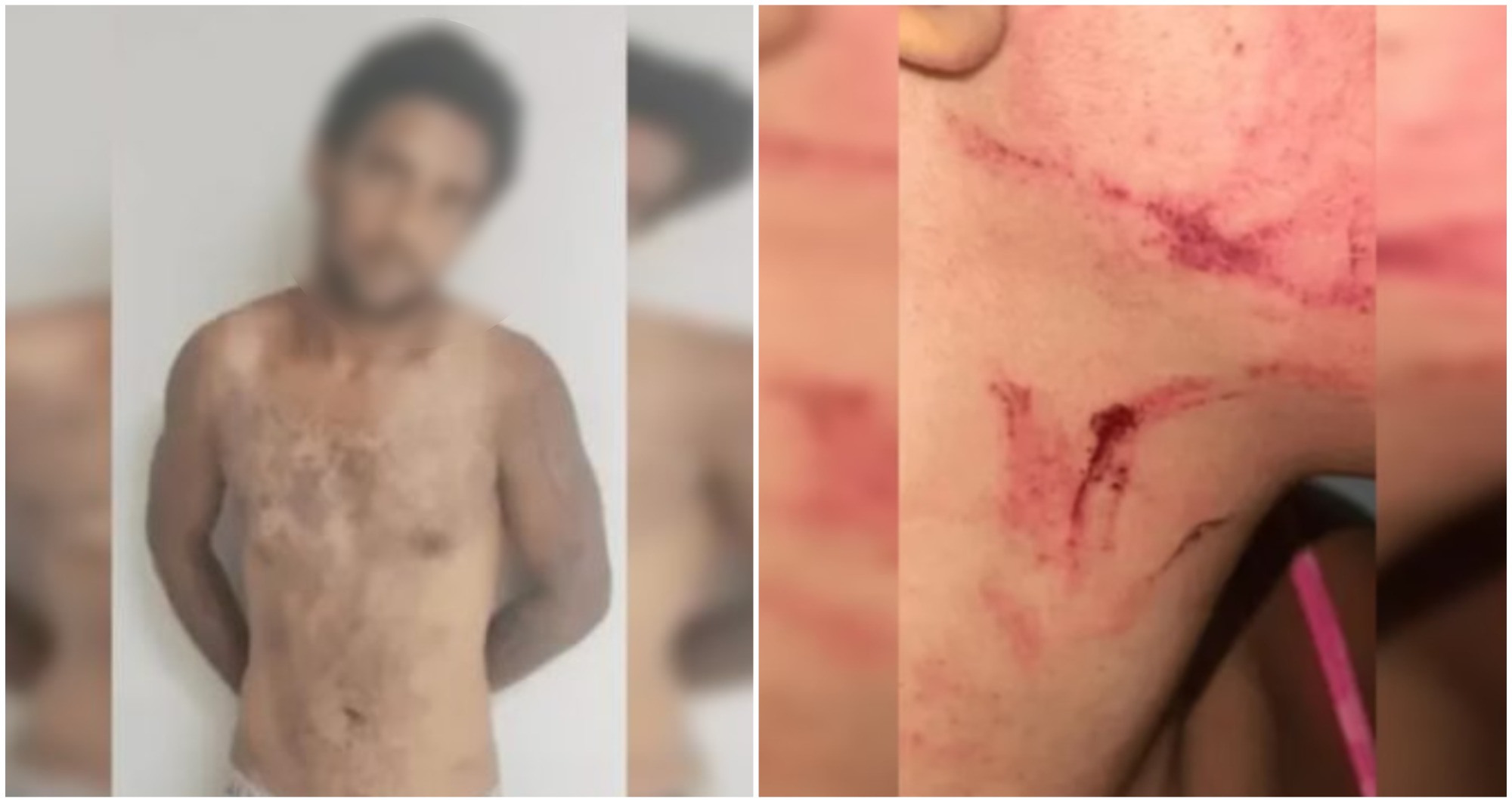 "Vampirão" é preso após tentar matar mulher para beber seu sangue "Vampirão" é preso após tentar matar mulher para beber seu sangue
