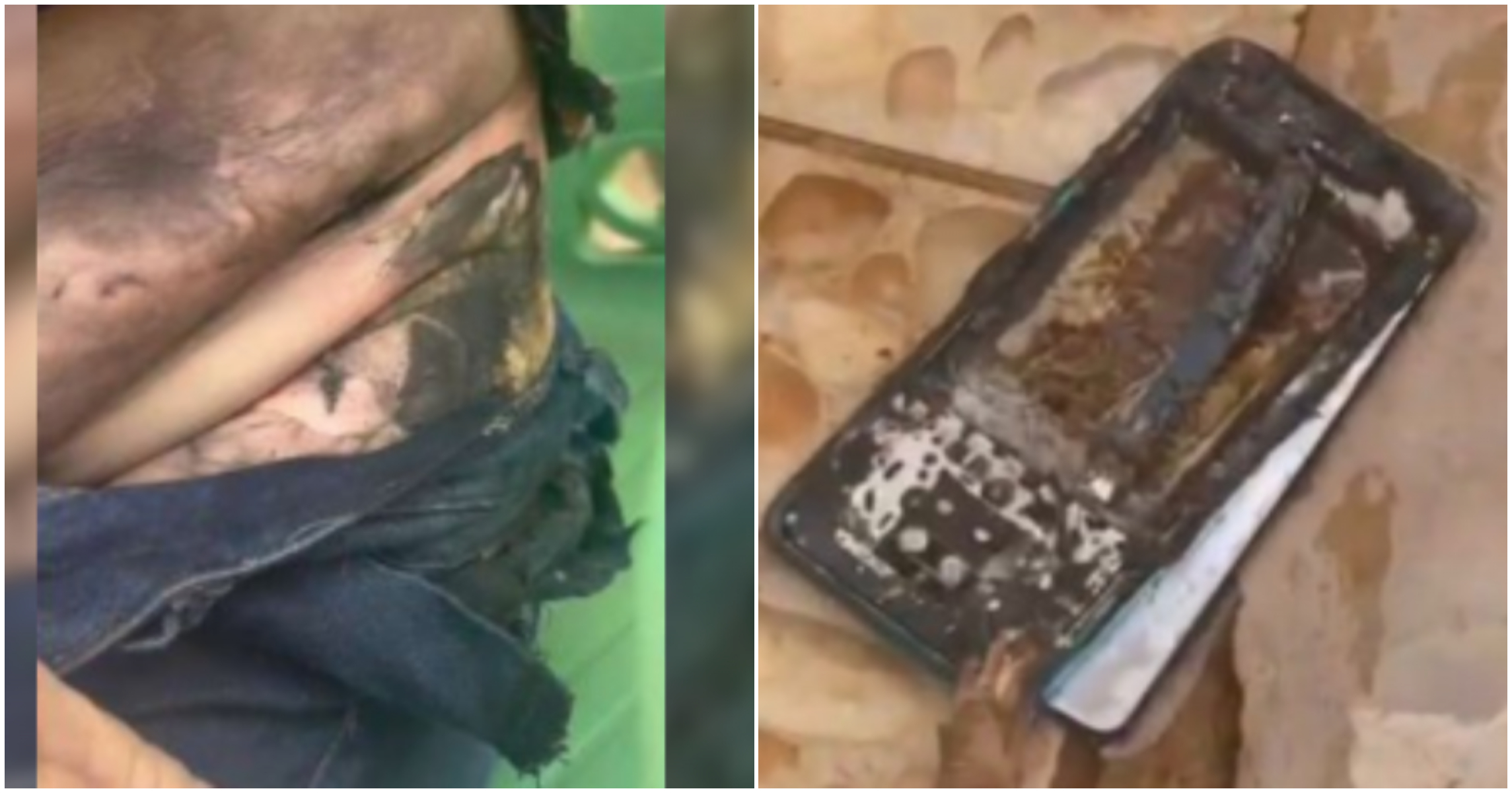 Pânico na estrada: celular explode no bolso de motociclista que fica gravemente ferida