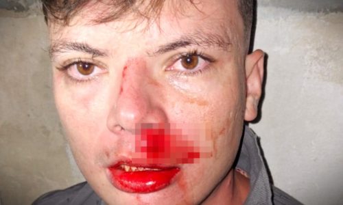 Assessores de deputado estadual do PT são agredidos no Paraná Imagem referente a Assessores de deputado estadual do PT são agredidos no Paraná
