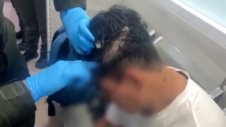 Deu ruim: Homem esconde cocaína na peruca e acaba preso no aeroporto; veja o vídeo