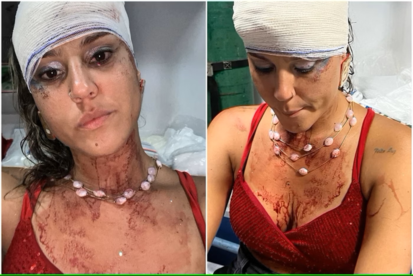 Violência policial no carnaval: Mulher denuncia agressão durante bloco Violência policial no carnaval: Mulher denuncia agressão durante bloco