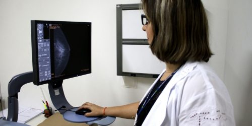 Entidades médicas pedem faixa etária maior para mamografia de rastreio Imagem referente a Entidades médicas pedem faixa etária maior para mamografia de rastreio