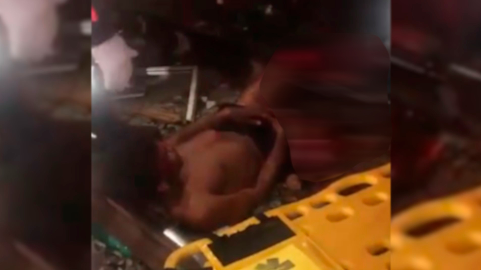 Imagens fortes: Homem dorme nos trilhos de trem e acorda com as pernas trituradas