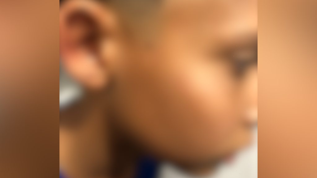 Criança leva tapa no rosto por homem que estava em lanchonete do Terminal Sul