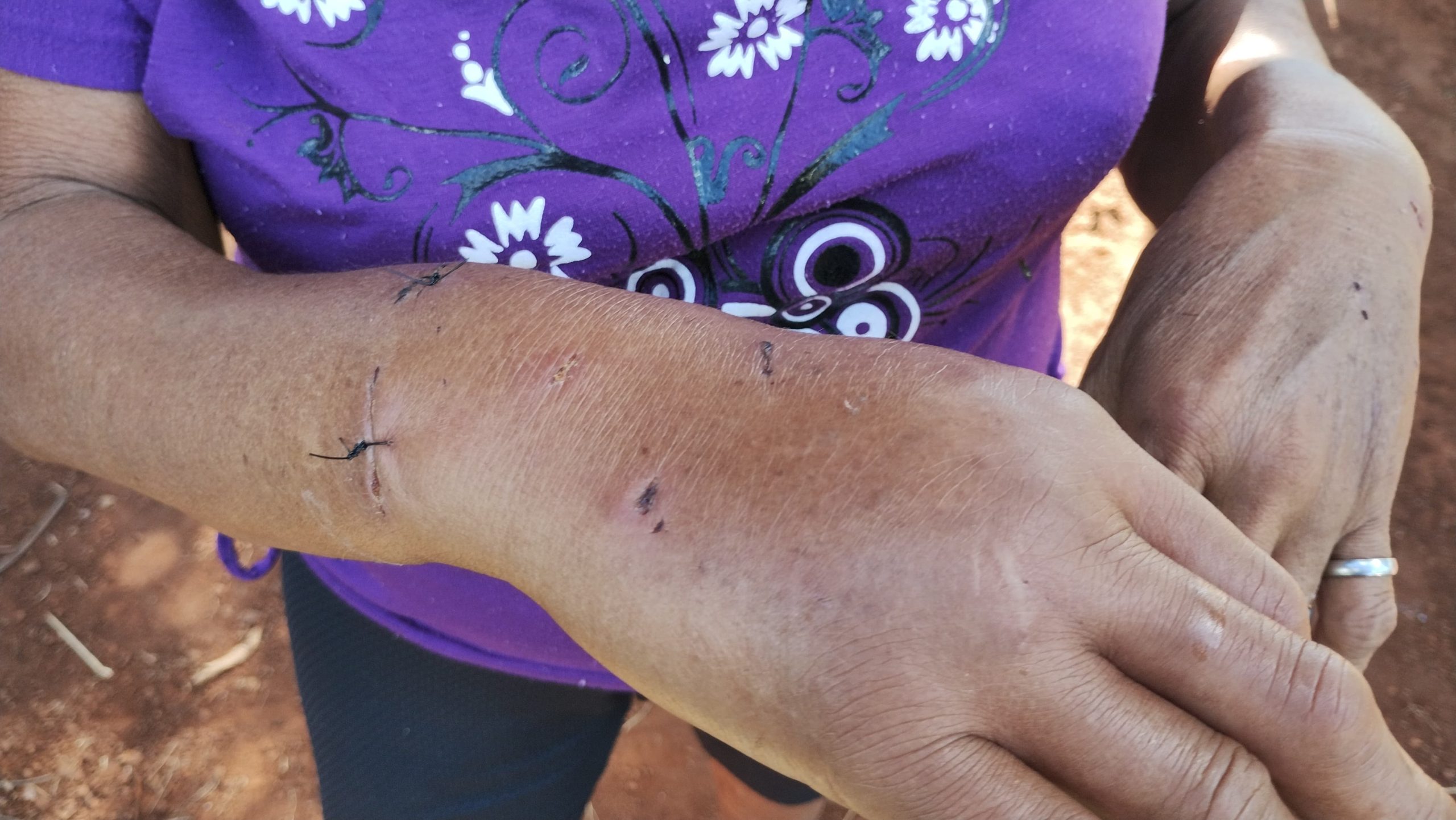 Cão estaria agressivo e atacou idosos antes de ser golpeado por facão no Morumbi Cão estaria agressivo e atacou idosos antes de ser golpeado por facão no Morumbi