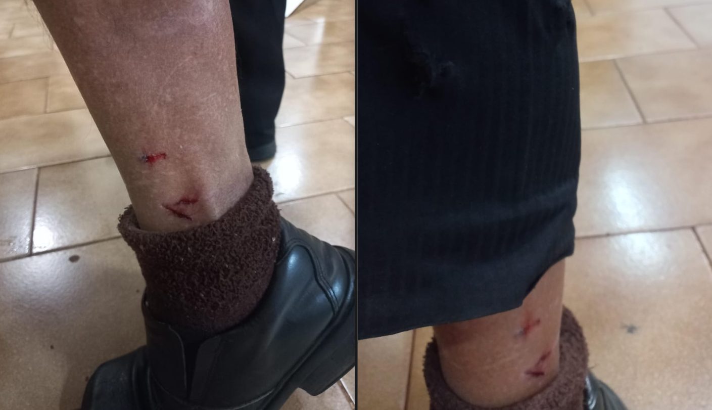 Idoso é mordido por cão no Bairro Alto Alegre; moradora deixa alerta e faz desabafo