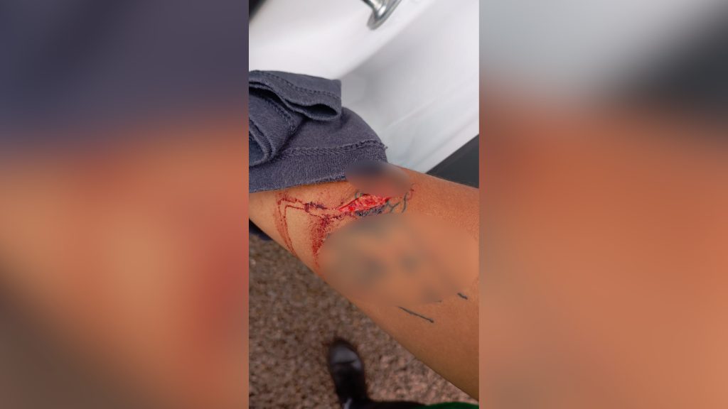Ex-companheiro venezuelano usa faca em agressão após discussão por celular