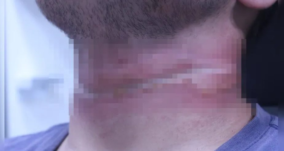 Motociclista é quase ‘degolado’ por fio solto entre postes