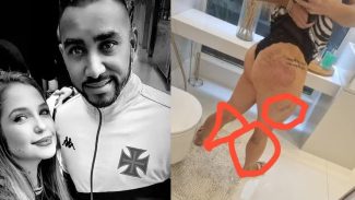 Advogada acusa Payet, do Vasco, de agressões durante sexo