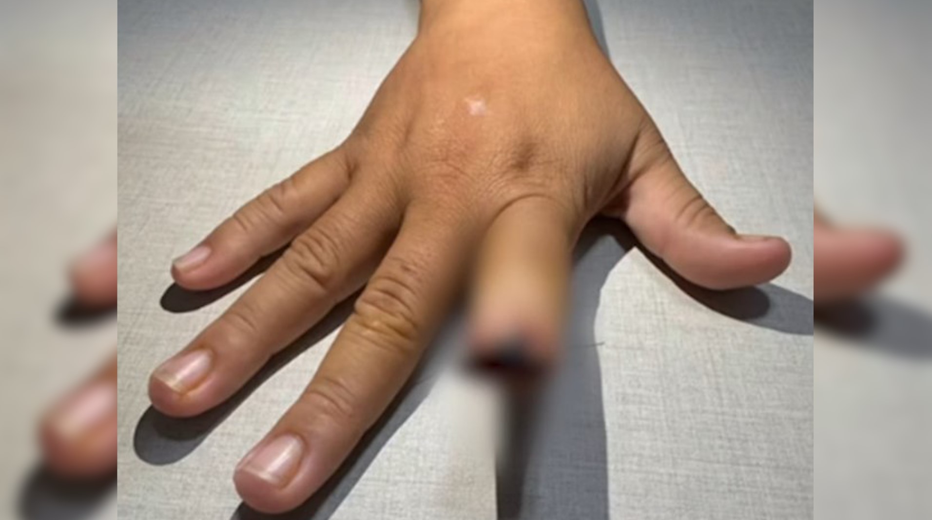 Homem arranca dedo de namorada a dentadas após briga e cospe no chão Homem arranca dedo de namorada a dentadas após briga e cospe no chão