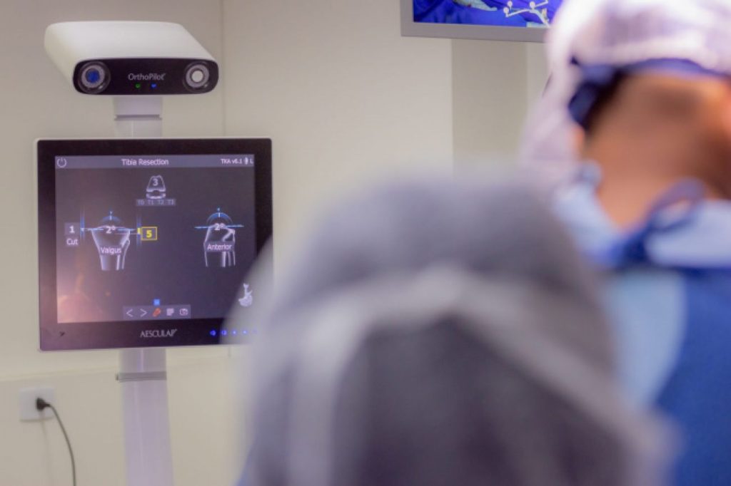 Com navegador cirúrgico, HU-UEPG ganha mais tecnologia para cirurgias ortopédicas Com navegador cirúrgico, HU-UEPG ganha mais tecnologia para cirurgias ortopédicas
