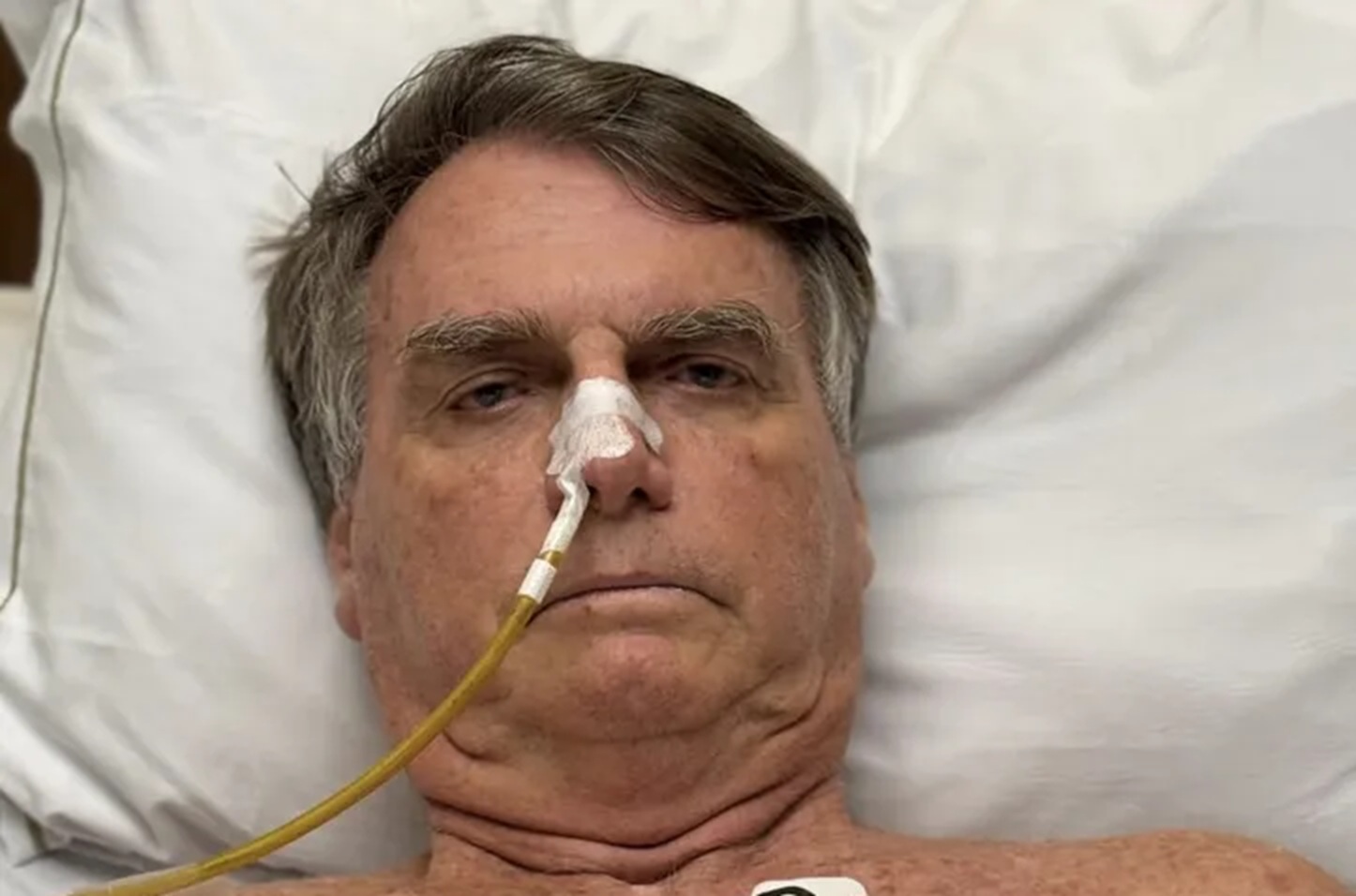 Bolsonaro recebe alta da UTI e segue internado em hospital de Brasília, diz boletim médico