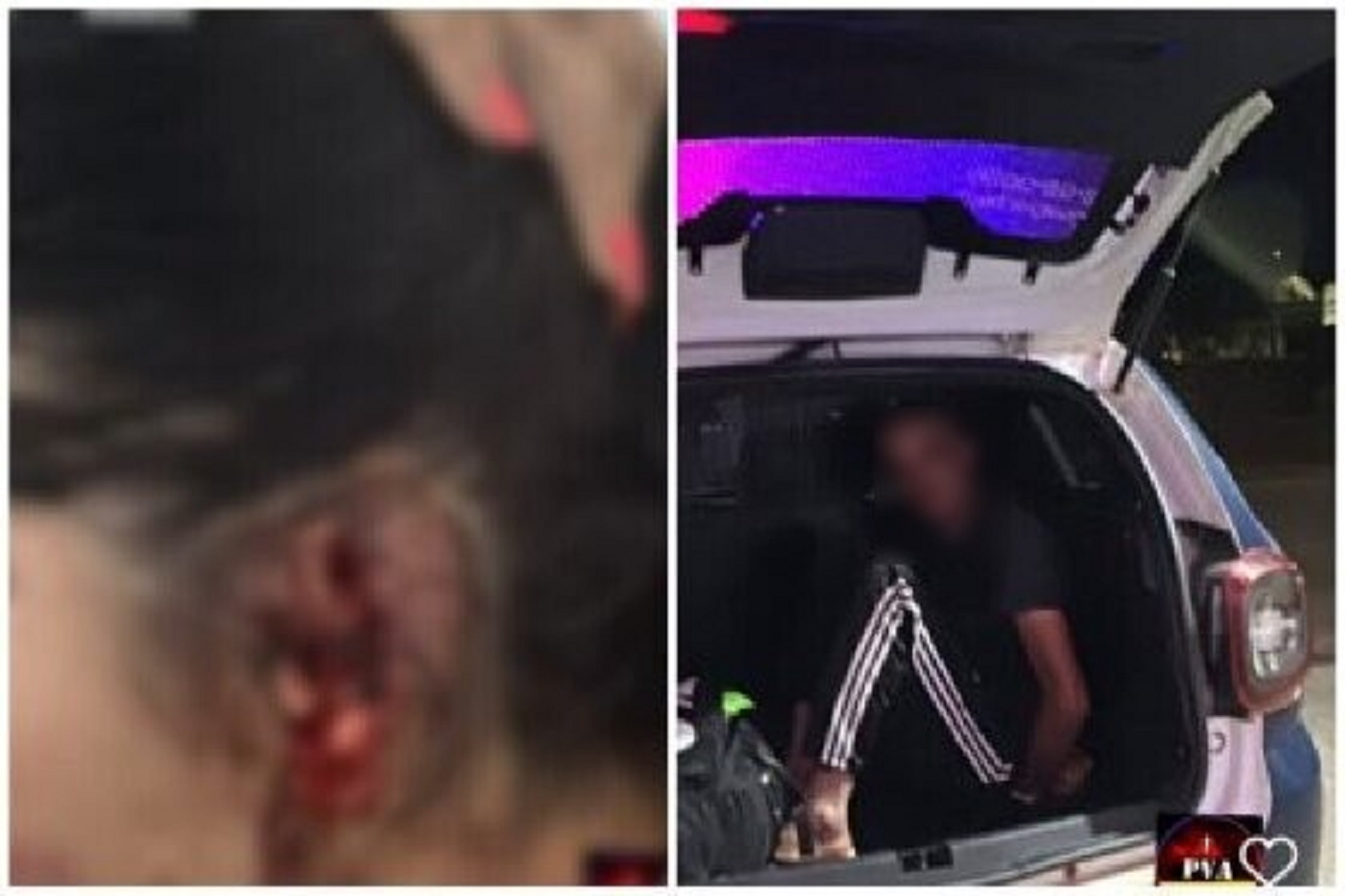 Homem arranca orelha da esposa durante agressão e acaba preso Homem arranca orelha da esposa durante agressão e acaba preso